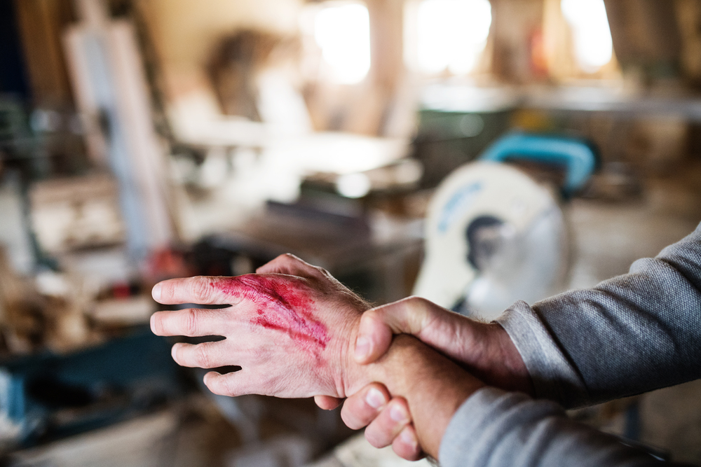 Immediate Steps to Take After a Machine Crush Hand Injury