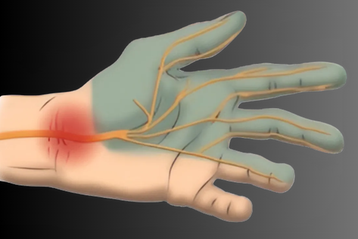 Hand & Wrist Treatments in Ahmedabad | Krisha Hand Hospital