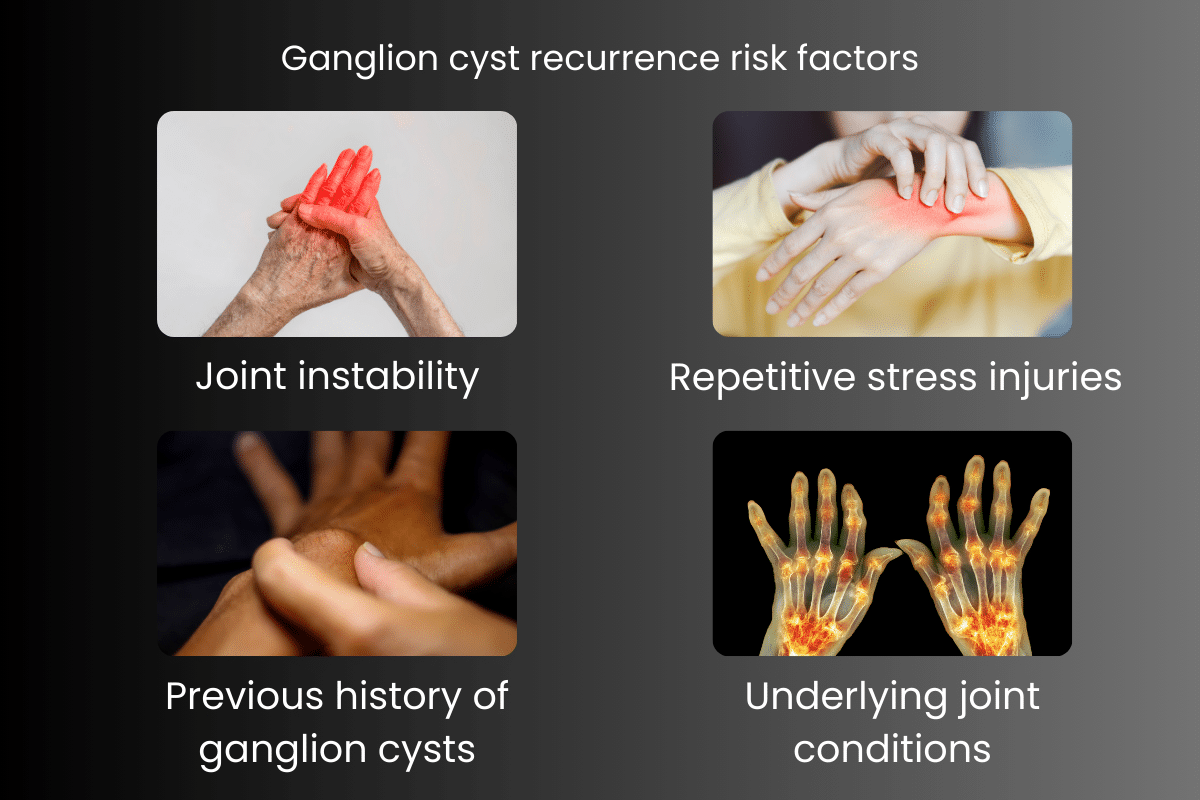 Ganglion cyst recurrence risk factors