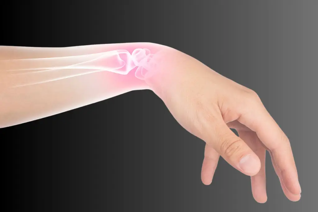 fracture in hand pic