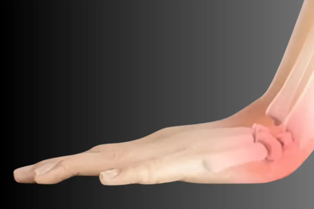 Wrist & Hand sprains