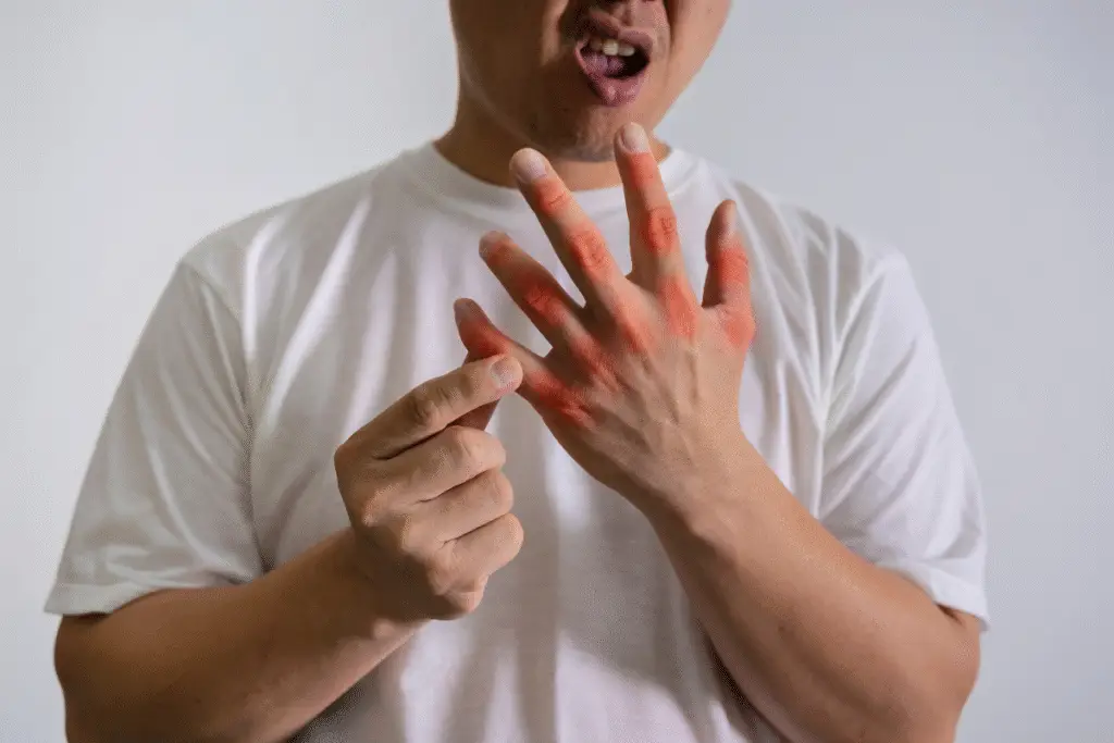 sore finger joints