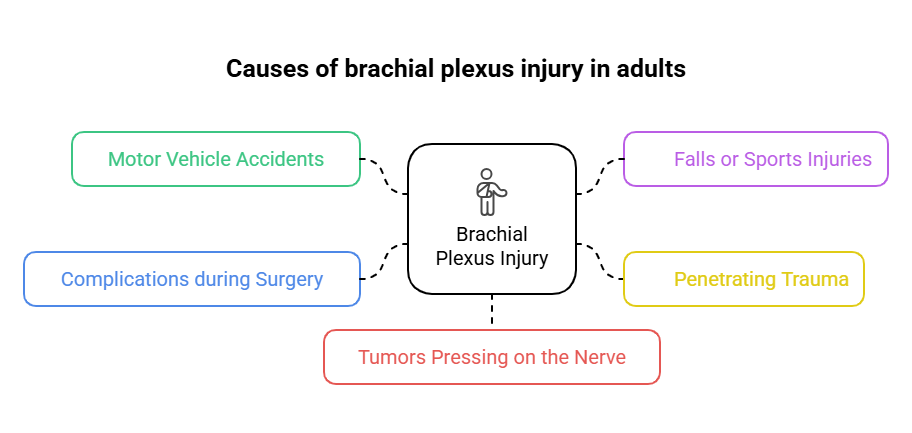 Causes of brachial plexus injury in adults