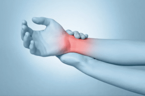 Colles’ fracture