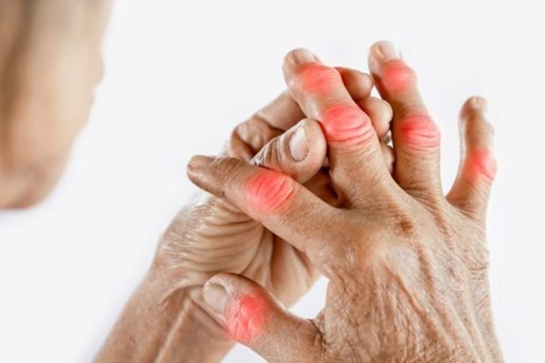 Sore hands and Fingers: Common reasons and Effective remedies