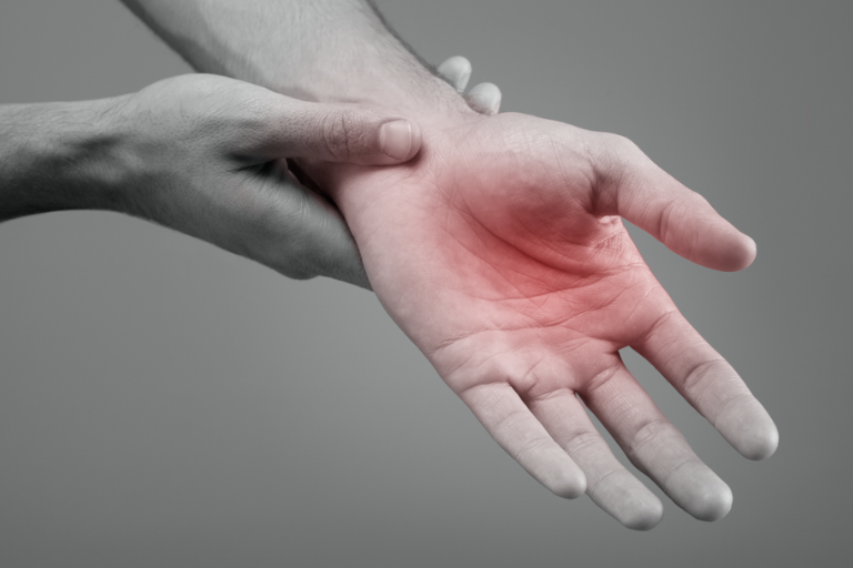 Can a hand muscle contusion lead to long-Term stiffness?