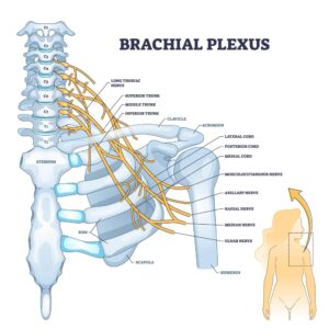 Brachial Plexus Injury