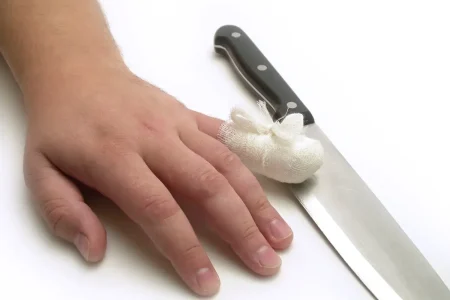 Cuts & Lacerations