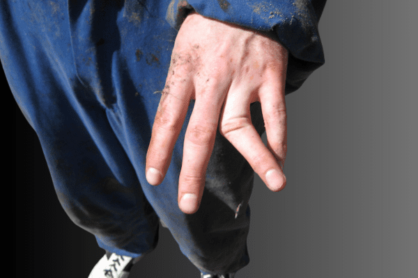 Dislocations