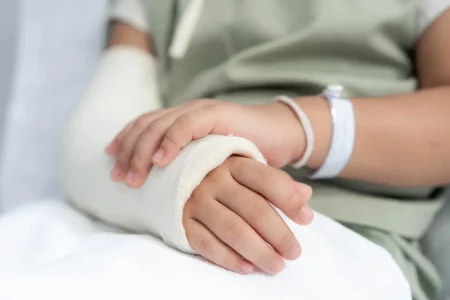 Hand fracture