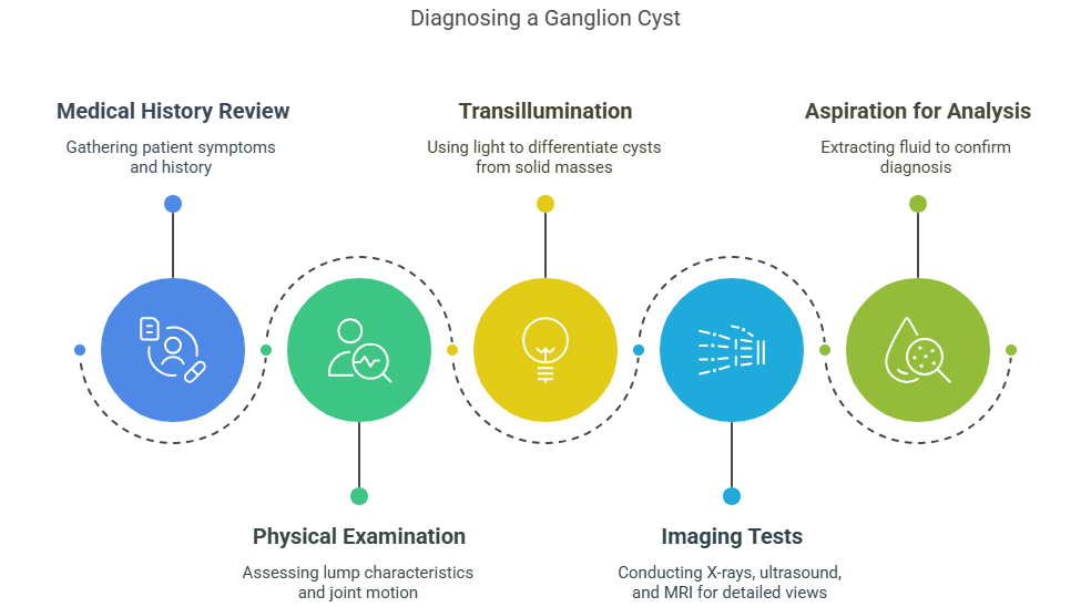 How is ganglion cyst diagnosed How is ganglion cyst diagnosed