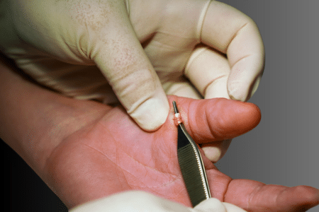Ligament repair surgery