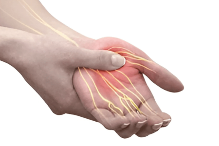 Peripheral nerve injuries & Compressive neuropathies