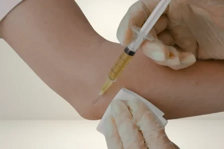 Platelet-Rich Plasma (PRP) therapy
