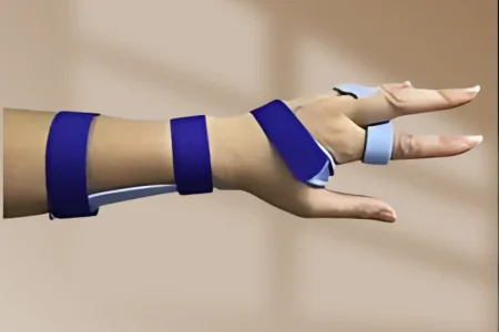 Rest & Immobilization