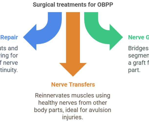 Surgical treatment for OBPP (Newborns) Surgical treatment for OBPP (Newborns)