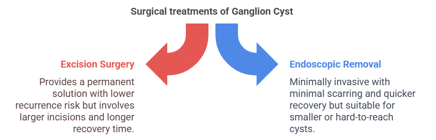 Surgical treatments of Ganglion Cyst Surgical treatments of Ganglion Cyst